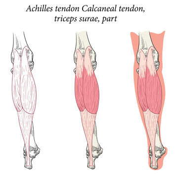 Medical Illustration Bacl View  Of Foot Achilles Tendon Calcaneal Tendon, Triceps Surae, Part. Specialized Images For Medicine, Student Learning, And Sports Science.