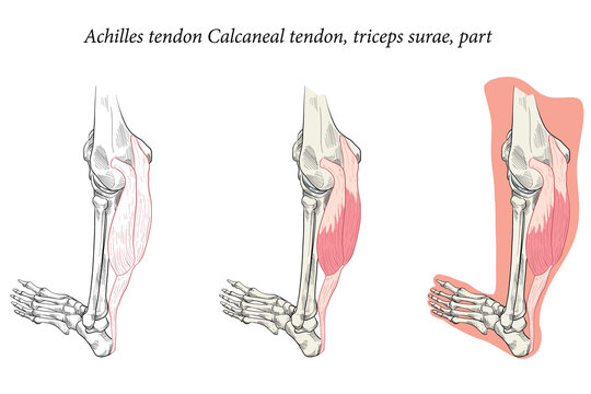 Medical illustration oblique side view of Foot Achilles tendon Calcaneal tendon, triceps surae, part. Specialized images for medicine, student learning, and sports science.