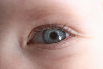 Young girl's eye with blue pupil. Childhood vision examination concept