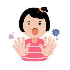 Girl have blister on her skin.