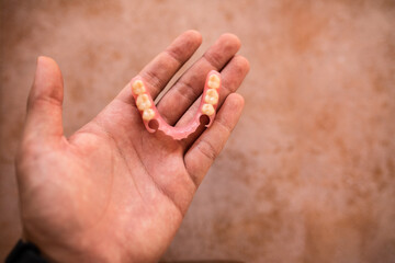 flexible nylon denture on male hand. Removable dentures flexible, devoid of nylon, hypoallergenic...