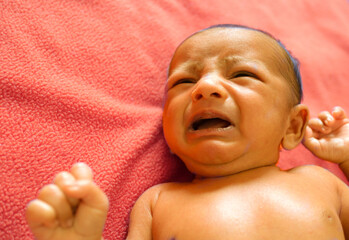a yellow skin colored neonatal jaundice baby crying in pain