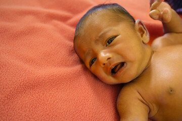 a yellow skin colored neonatal jaundice baby crying in pain