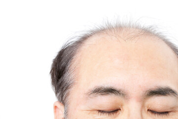 Fototapeta premium 薄毛の男性