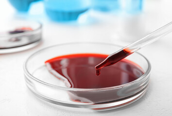 Dripping blood from pipette into Petri dish on table, closeup. Laboratory analysis