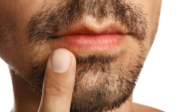 Young man with cold sore touching lips against white background, closeup