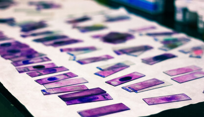 stained glass slides of peripheral blood smear with violet leishman giemsa stain in hematology...