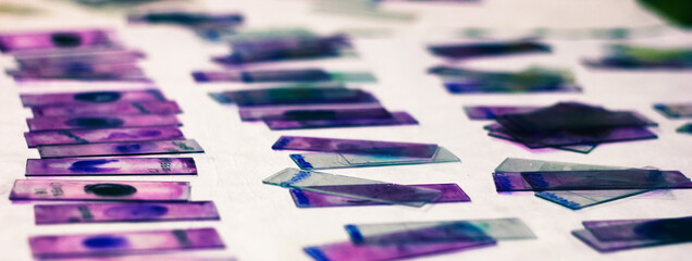stained glass slides of peripheral blood smear with violet leishman giemsa stain in hematology pathology laboratory