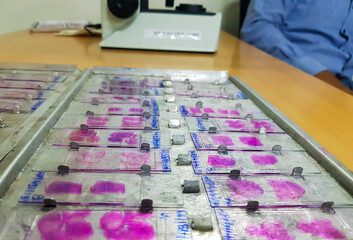 histopathology slides stained with leishman stain, displayed and ready for microscopy with selective focus on slides