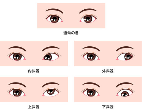 寄り目 Images Browse 50 Stock Photos Vectors And Video Adobe Stock