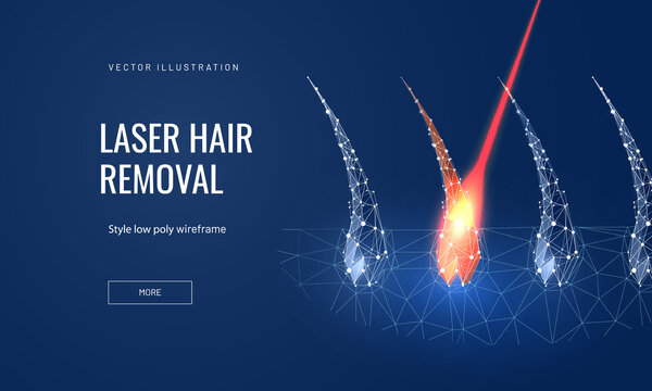 Laser Hair Removal Vector Images – Browse 5,149 Stock Photos, Vectors, and Video | Adobe Stock Laser Hair Removal Vector Images – Browse 5,149 Stock Photos, Vectors, and Video | Adobe Stock