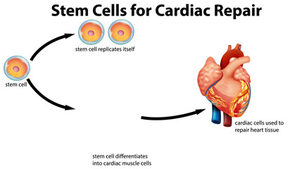 Obraz premium Stem cells for cardiac repair