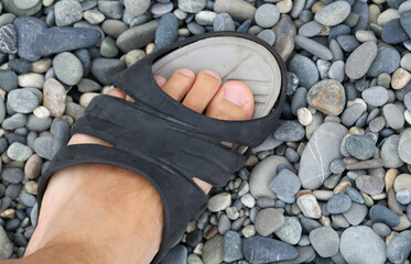 Man's leg on a pebble near the sea.