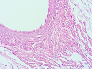 picture of histology human tissue with microscope from laboratory (not Illustration Designation)