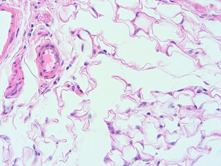 picture of histology human tissue with microscope from laboratory (not Illustration Designation)
