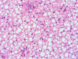 picture of histology human tissue with microscope from laboratory (not Illustration Designation)