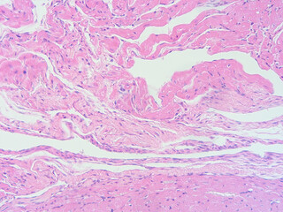 picture of histology human tissue with microscope from laboratory (not Illustration Designation)