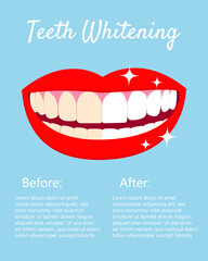 Teeth Whitening concept with laughed mouse and teeth before and after bleaching. With text places. Good for banners, posters. Vector isolated elemnts on blue background EPS10