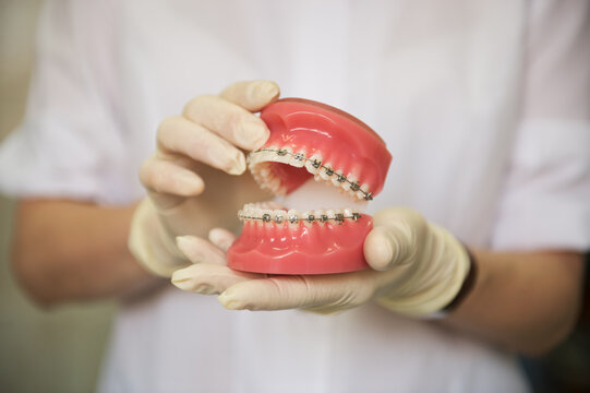 Dentist holding teeth model