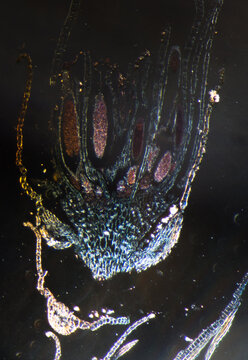 polyrtichum archegonis, moss reproductive parts
