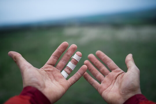 male palms with finger injury