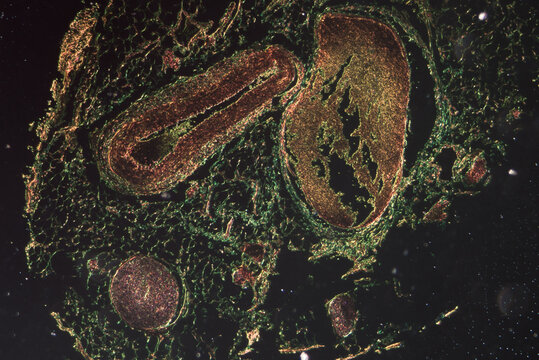 venae cava