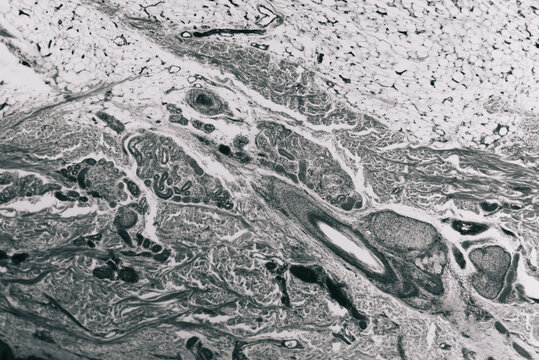 Human skin hair follicle section