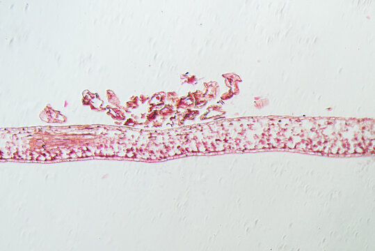 fern leaf-sorus c.s.