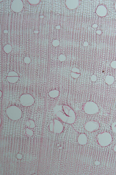 stem cork cells