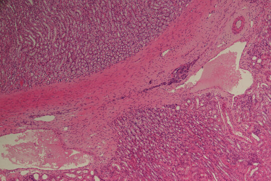 Kidney of animal rabbit