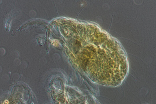 peach pest mite worm, micrograph