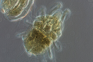 peach pest mite worm, micrograph