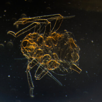 cotton pest worm, micrograph