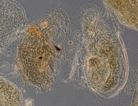 peach pest mite worm, micrograph