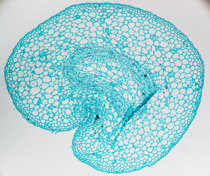 soybean stem, micrograph