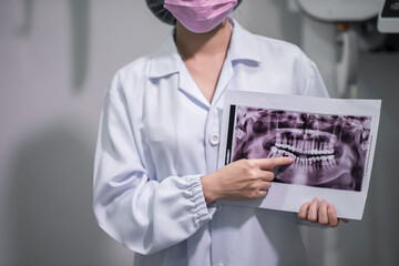 Image of doctor or dentist presenting with tooth x-ray film recommend patient in the treatment of dental and dentistry, working at workplace.