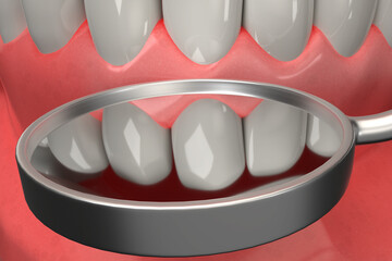3D rendering from a dental check with a stomatoscope after brace remove, extrem closeup - 375837624