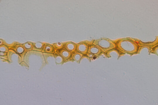 Plasmodesmata of cells