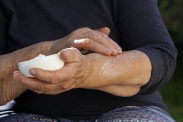 Elderly woman with very dry skin applying moisturizing lotion on her arms