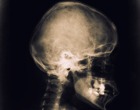 Human skul x-ray image. Roentgen of adult woman head