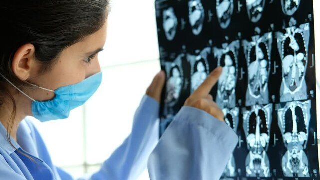 close up of female doctor analysing abodemn thomography. MRI scan results. pulomonary disease