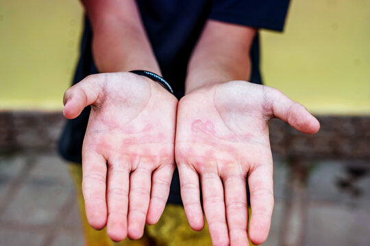 The palms are rubbed into the mazol. Child's hands.