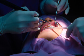 Dentist and nurse making professional teeth cleaning patient and doing dental scaling at the dental...