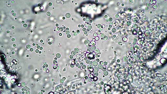 Lactobacilli in breast yeast under magnification of the microscope. Microcosmic background. The theme of lactic acid foods is under 1000x magnification. Bacteria useful for the human body from yogurt.