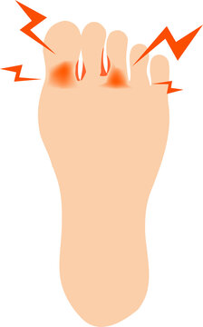 416 Best 水虫 Images Stock Photos Vectors Adobe Stock