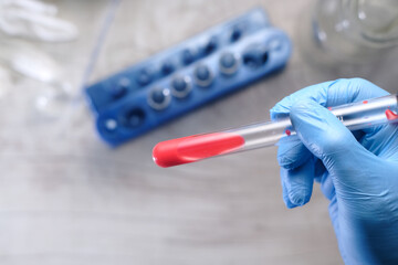 laboratory technician hand holding blood test tube 
