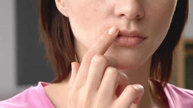 Young woman with cold sore applying remedy on her lips at home, closeup