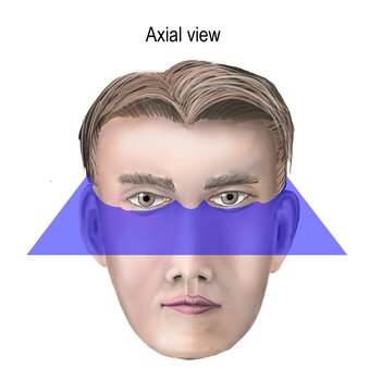 The Difference Slides Of Brain Imaging Regarding To CT And MRI Images. Coronal, Saggital And Axial View Were Demonstrated.