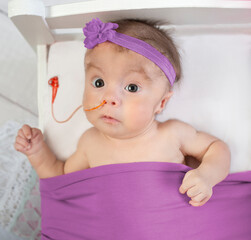 Special needs Trisomy 18 infant baby girl with feeding tube in tiny bed - 376358855