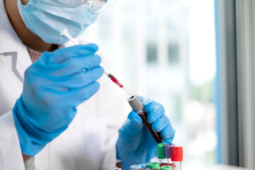 Professional doctors perform find virus tests from samples of blood tests to diagnose coronary...